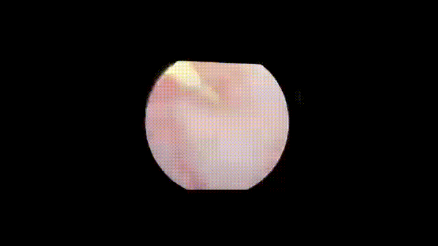 2.gif